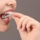 A close up of a person's mouth putting in a clear occlusal mouth guard up against a brown background.