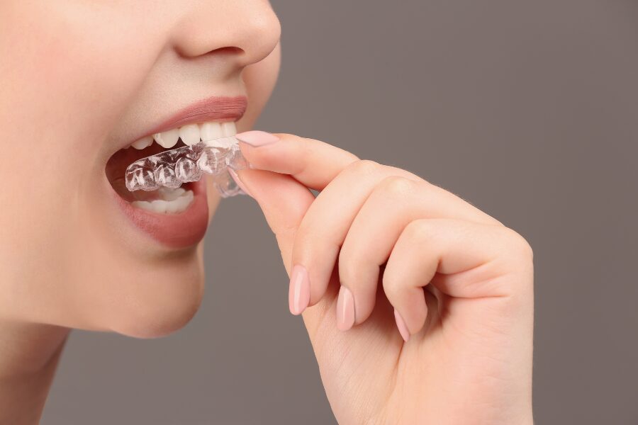 A close up of  a person's mouth putting in a clear occlusal mouth guard up against a brown background.
