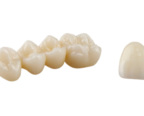 Close-up photograph displaying zirconia crown dental restorations, showcasing their detailed structure and texture, set against a clean white background.
