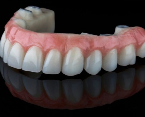 Picture of a hybrid dental implant against a black background.