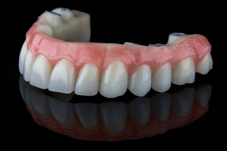 Picture of a dental implant against a black background.