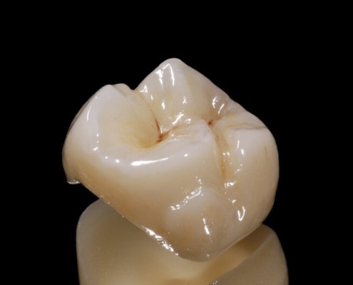 Picture of a ceramic crown against a black background.