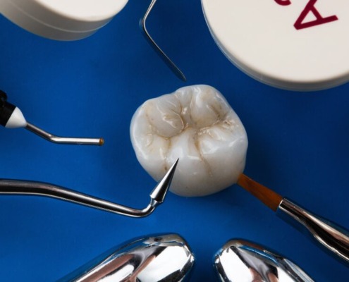 Dental crown preparation with different dental instruments and composites on a blue background.