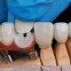 Doctor's hand installs a dental veneer on hybrid prosthesis bridge on black background