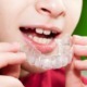 Close up photo of a child holding a clear dental guard, as if he is going to put it in his mouth.