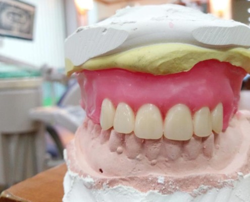 Close up of a denture molded from green and white wax