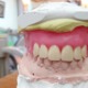 Close up of a denture molded from green and white wax