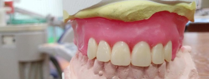 Close up of a denture molded from green and white wax